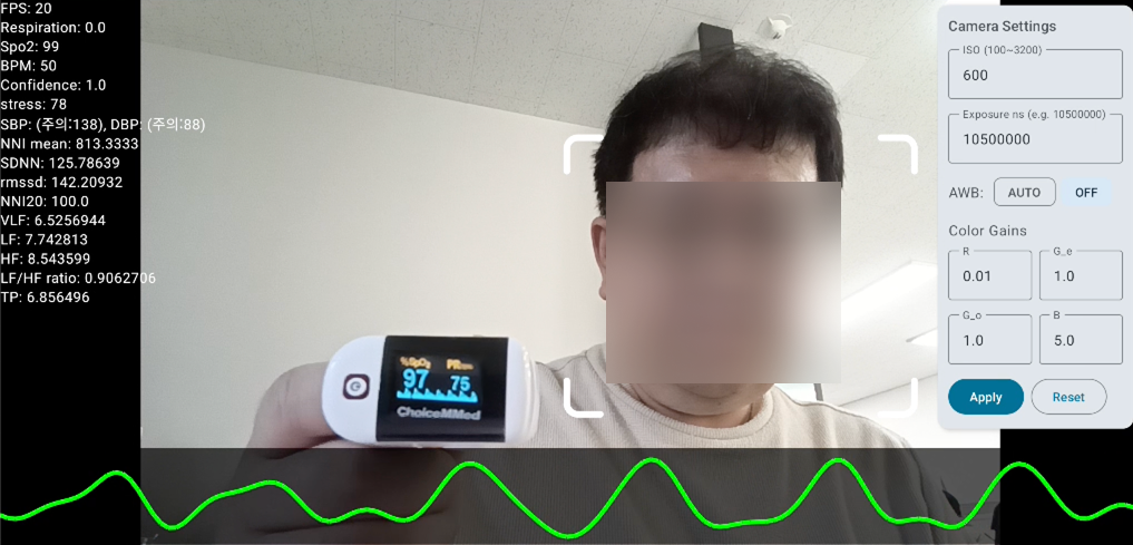 A사 측정 확인 방법