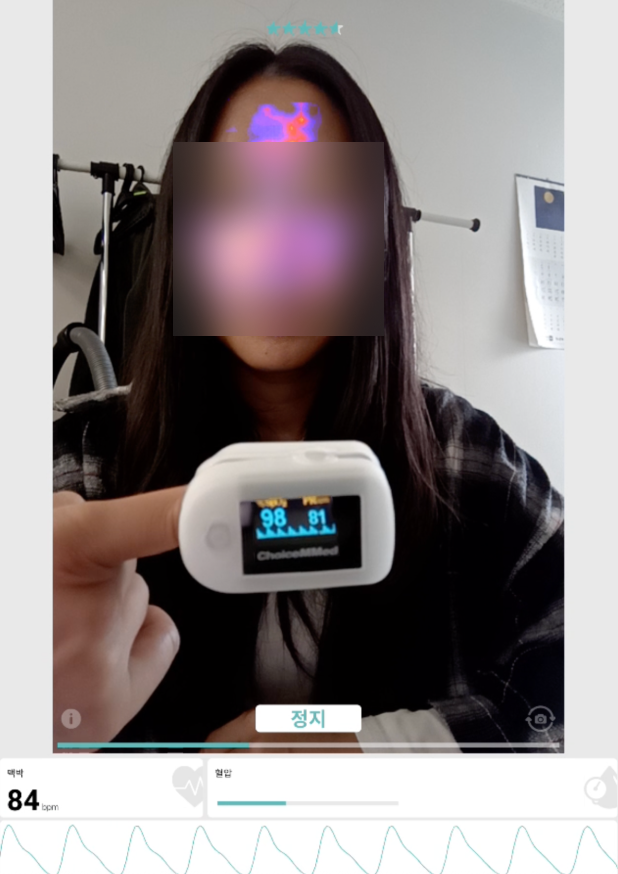 B사 측정 확인 방법